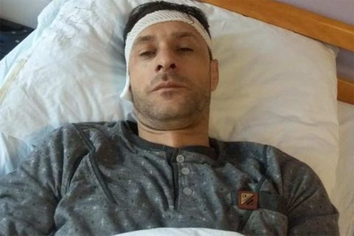 Ocu dvoje djece neophodan novac za operaciju tumora na uhu