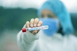 U Srpskoj 20 novozaraženih
