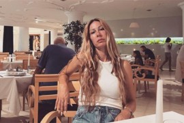 Vesna Đogani pokazala kako izgleda nakon botoksa
