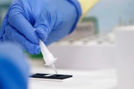 U posljednja tri dana u Srpskoj 36 osoba zaraženo koronom