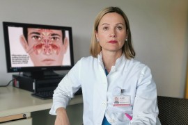 Prirodnim preparatima do zdravih sinusa