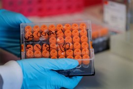 Devet preminulih, zaražena još 761 osoba u Srbiji