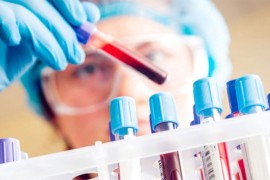 Krv napravljena u laboratoriji prvi put ubrizgana u čovjeka