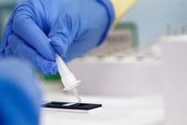U Srpskoj još devet zaraženih, nema preminulih