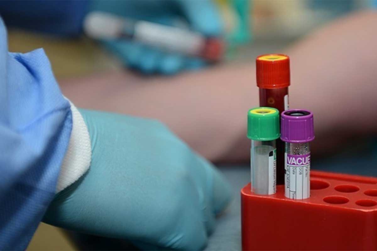 U Srbiji zaražena 801 osoba, preminulo osam