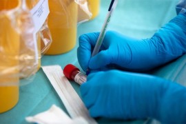 U Srbiji još 692 nova slučaja kovida, preminulo šest osoba