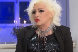 Poznata pjevačica slomila obje ruke