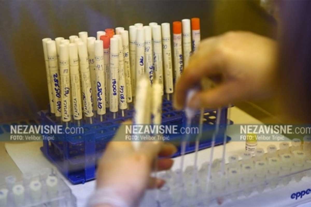 U Srpskoj koronom zaraženo 11 osoba