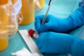 U Srbiji koronom zaraženo 367 osoba, preminulo sedam