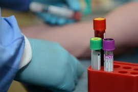 U Srbiji 541 slučaj virusa korona, preminulo pet osoba