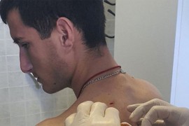 Đuzić stabilno, dvojica napadača na slobodi
