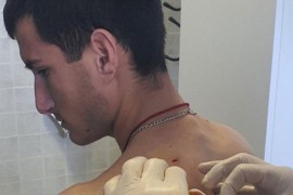 Krivična prijava protiv srpskog mladića kog je izbo Albanac