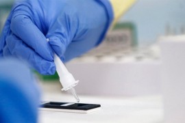 U protekla tri dana u Srpskoj koronom zaraženo 15 osoba