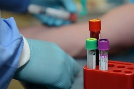 U Srbiji 879 novozaraženih, preminulo još pet osoba