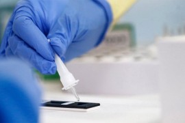 Devet novih slučajeva korone u Srpskoj