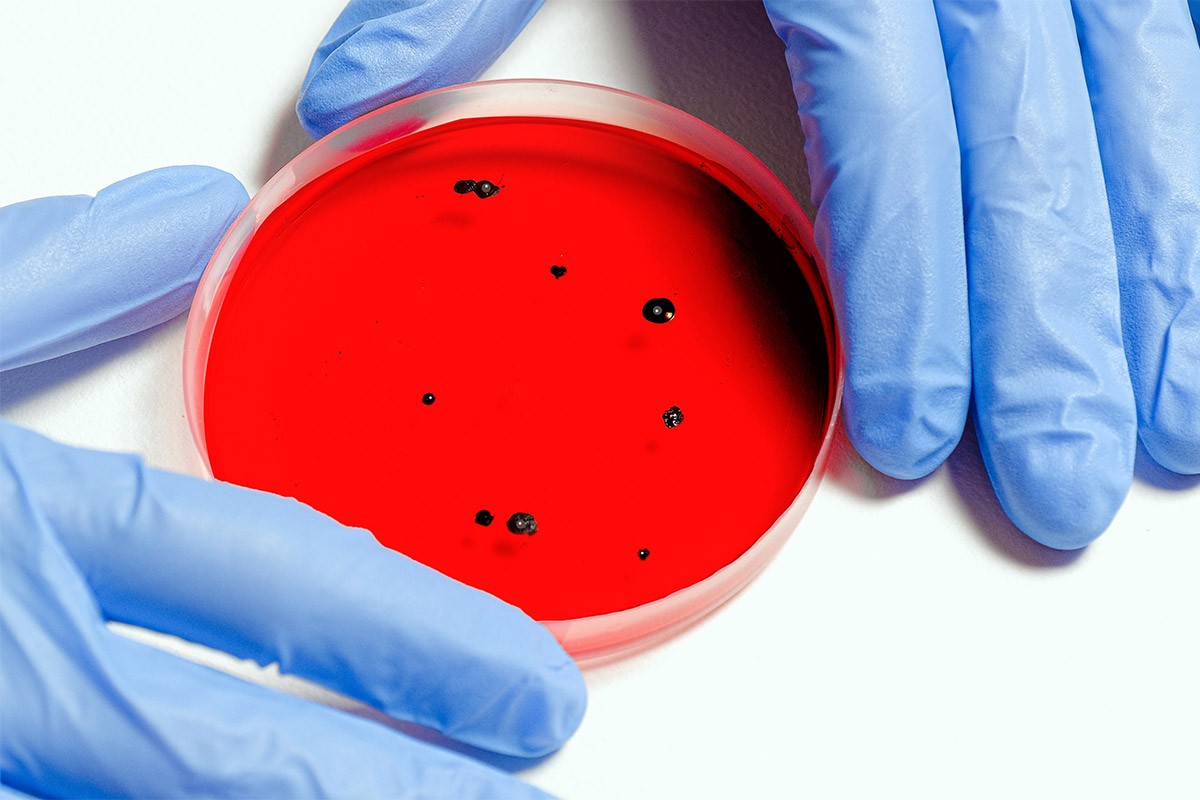 SZO: Virus marburg odnio devet života, u karantinu više od 200 ljudi