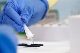 Za tri dana virus korona potvrđen kod 15 osoba, četiri preminula