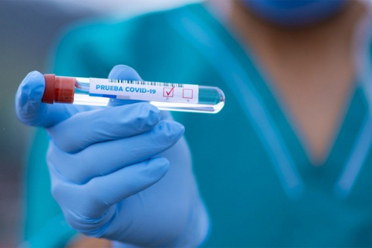 Virus korona potvrđen kod 10 osoba u Srpskoj