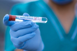 U Srpskoj koronom zaraženo šest osoba