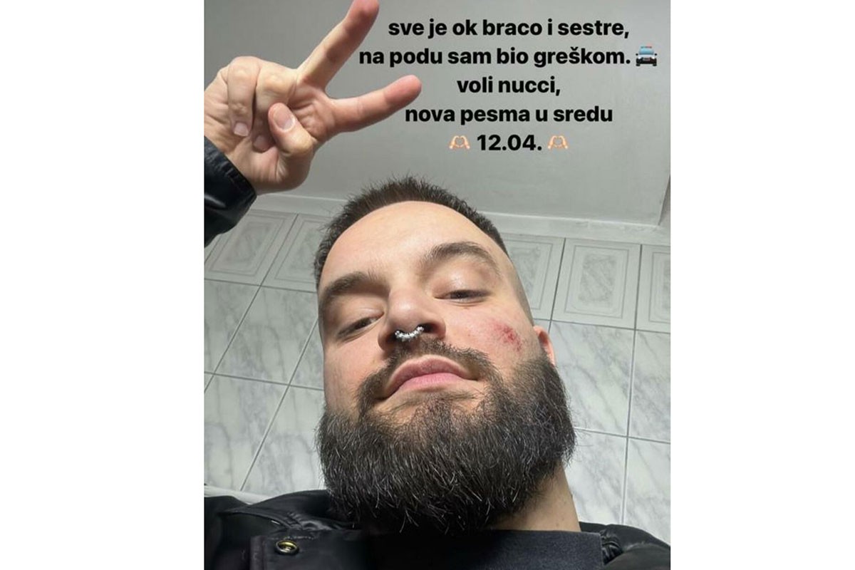 Oglasio se Nući nakon pucnjave u Fristajleru: Bio na podu, ima ogrebotine na licu