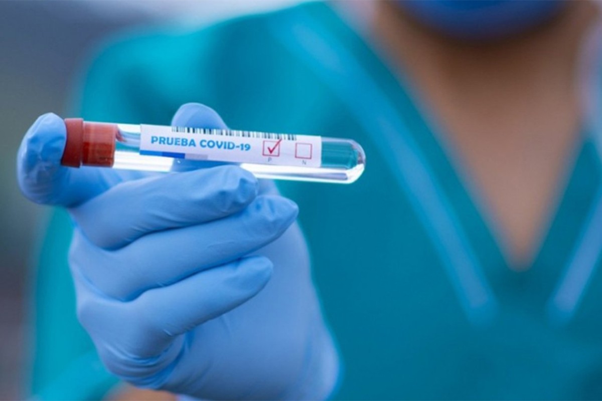 Na virus korona pozitivno 12 osoba u Srpskoj
