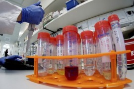 Epidemija teškog respiratornog virusa u Čileu