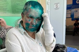 Ruska novinarka pretučena u Čečeniji: "Prislonili su pištolj na ...