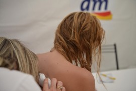 Banjaluka: U subotu besplatni dermatološki pregledi u organizaciji dm-a