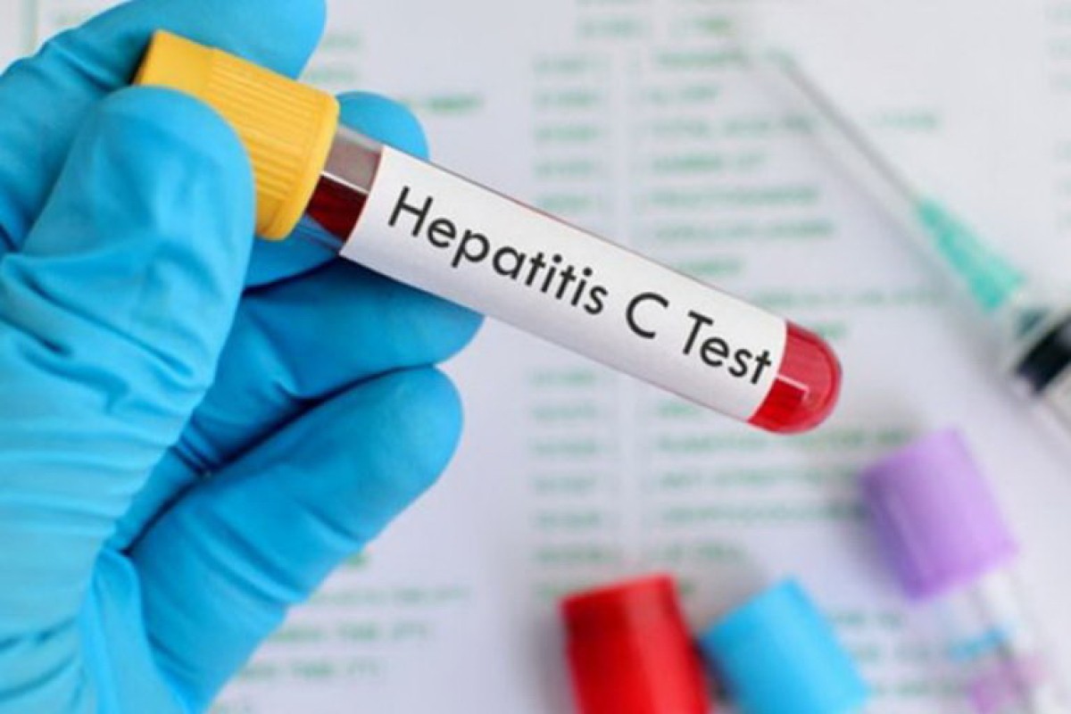 Broj oboljelih od hepatitisa u FBiH raste, u Srpskoj stagnira