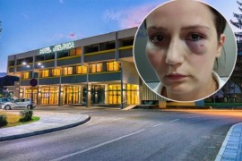Pretučena radnica iz Jablanice uoči protesta: Očekujem veliki broj ...