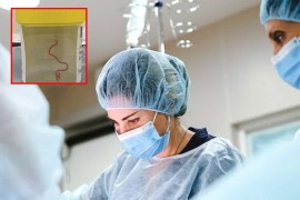 Ljekari u mozgu Australijanke pronašli živog crva od osam centimetara