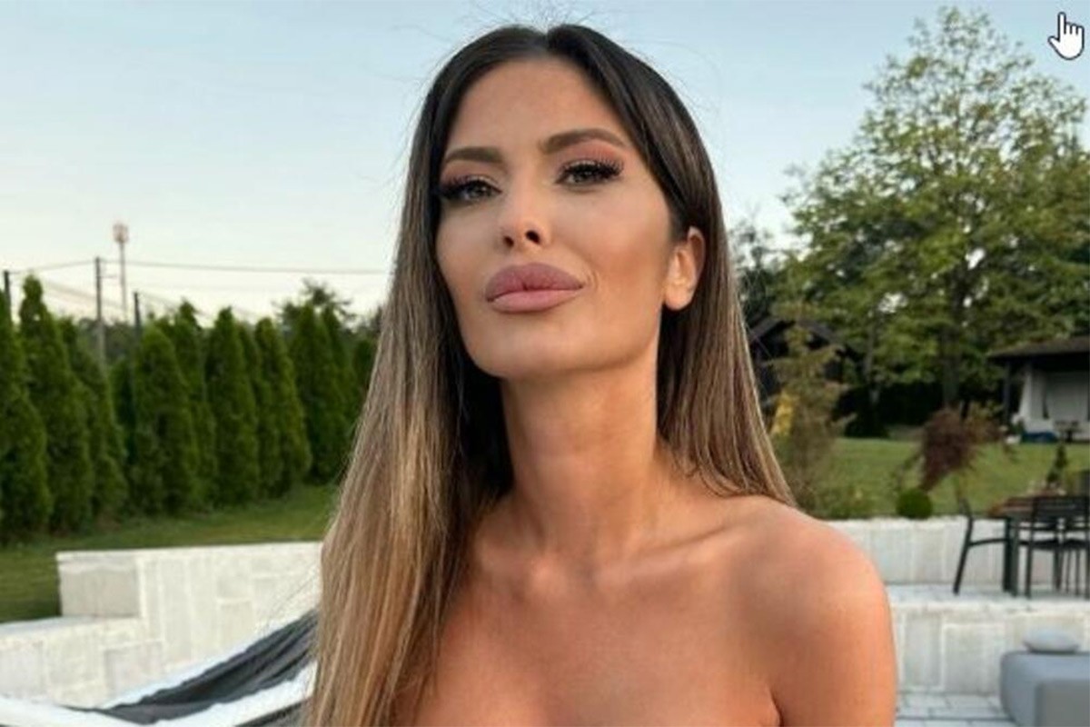 Pogledajte kako je Ana Radulović izgledala prije svih operacija