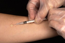 U Trebinju smanjen broj oboljelih od tuberkuloze