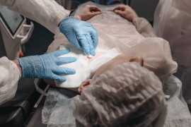 ​Vadili pacijentima bubrege i prodavali ih bogatašima