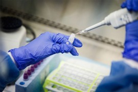 Troje preminulih od korone u Srpskoj