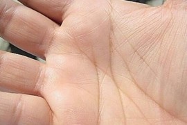 Ljudi koji imaju slovo "M" na dlanu nose poseban dar