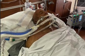 MMA borac  se bori za život: Spasio majku i oca iz kuće u plamenu