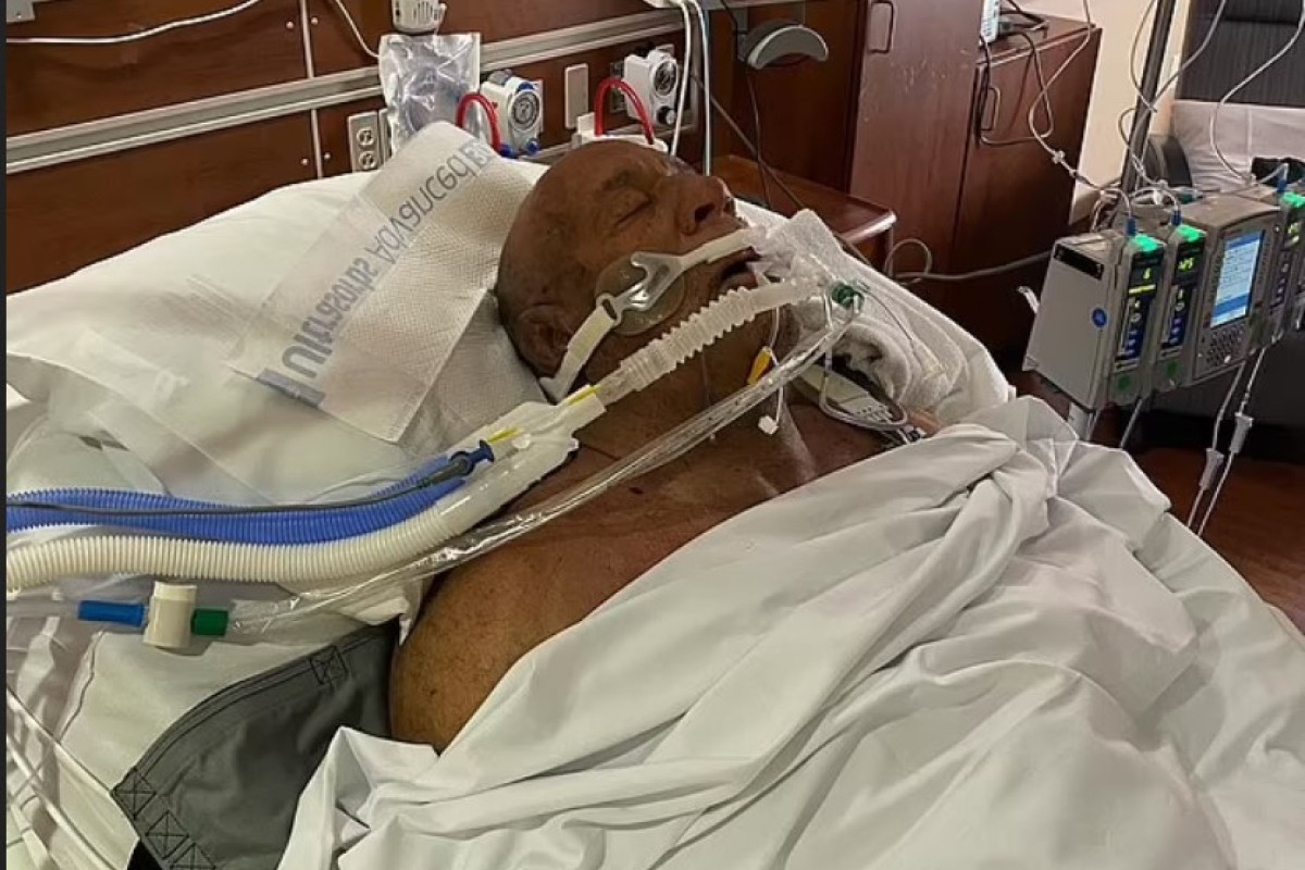 MMA borac  se bori za život: Spasio majku i oca iz kuće u plamenu