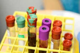 Anemični ste: Probajte ovaj recept