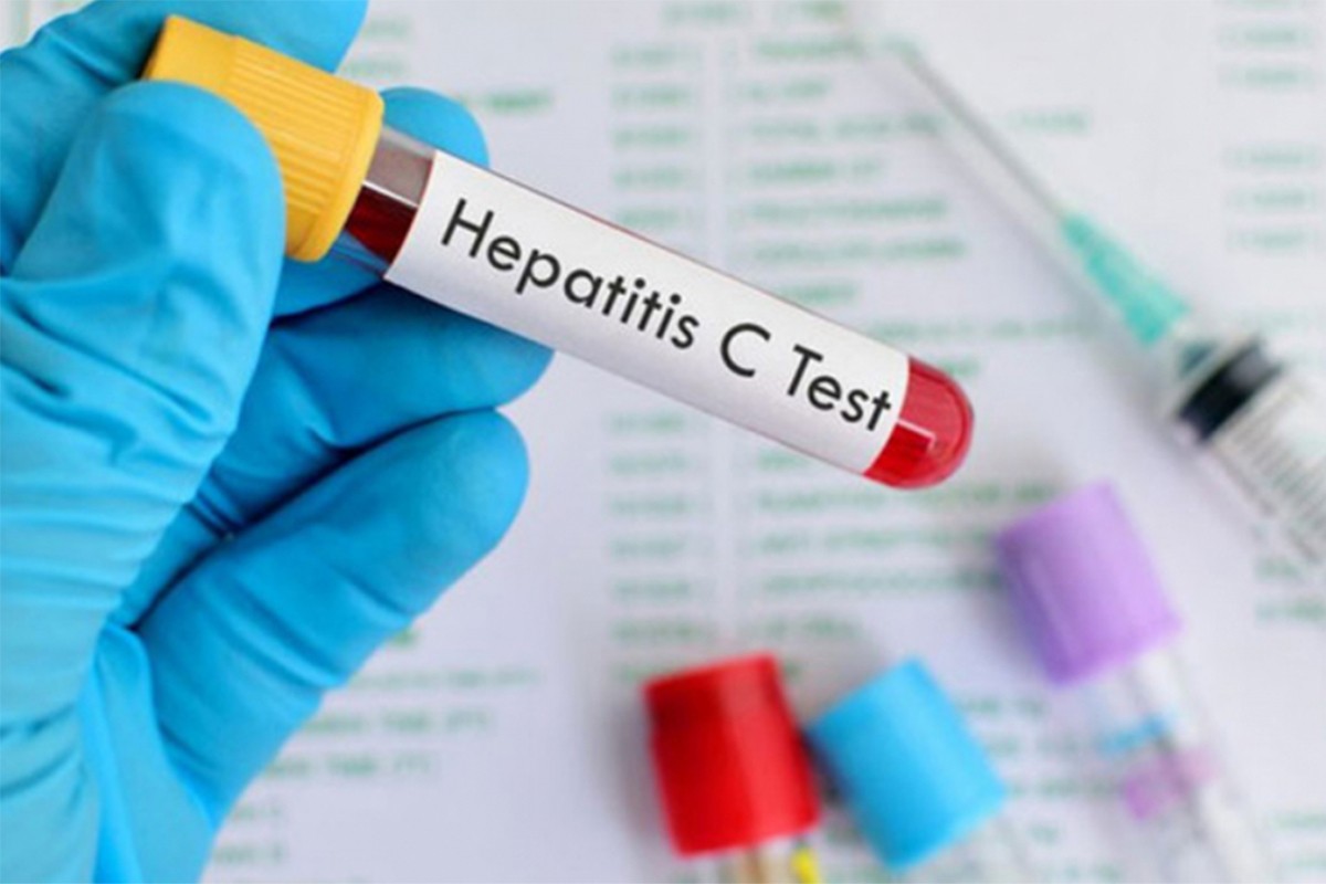 SZO: Virus hepatitisa dnevno ubije 3.500 ljudi