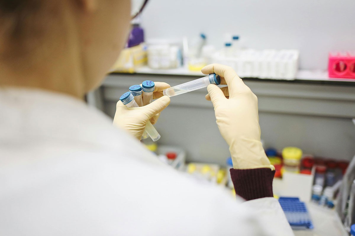 Zabrinjavajući podaci: Raste broj oboljelih od  hepatitisa B u Srpskoj