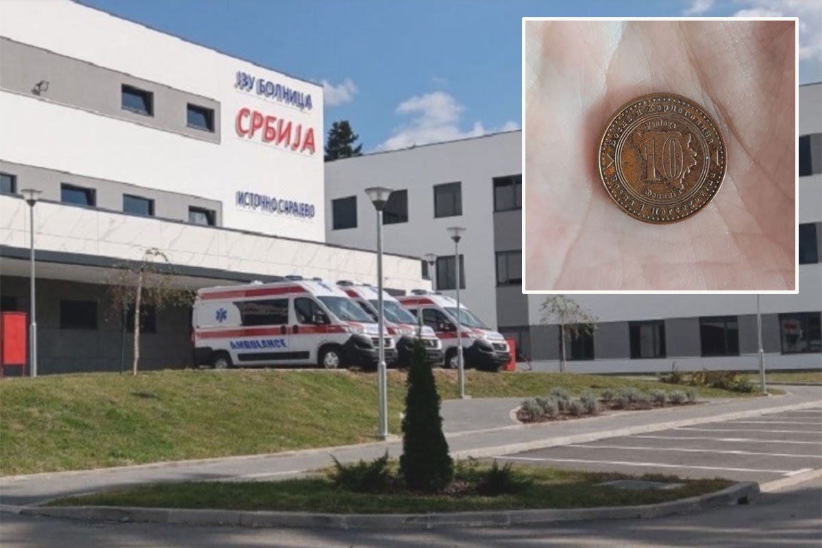 Nesvakidašnji slučaj: Dva dječaka u dva sata progutala po 10 feninga (FOTO)