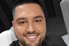 Ljuba Perućica otkrio koje estetske korekcije je radio