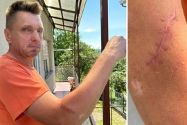 Muškarac kojeg je Pahoki tukao mjesec prije pokolja: Šivali su mi ruku