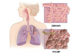 Šta je HOBP, bolest koju ima Bora Đorđević