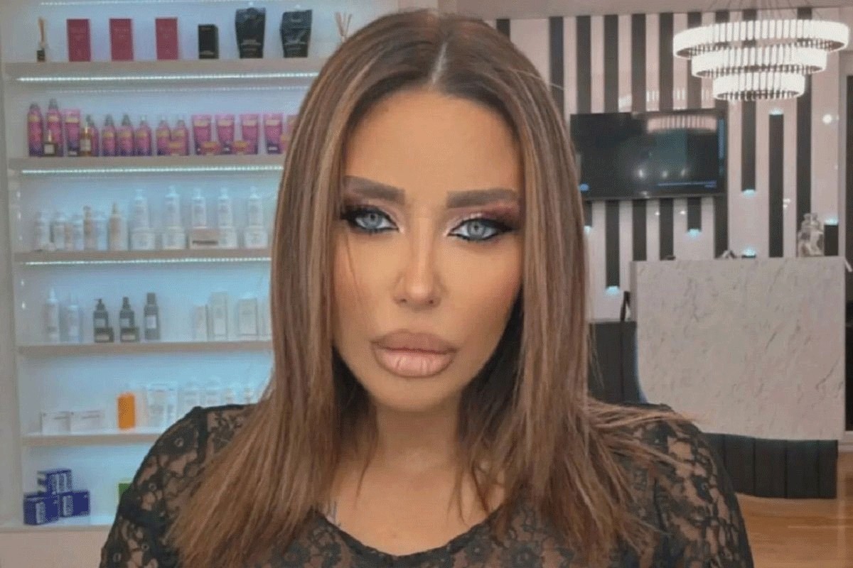Ana Nikolić tajno otišla pod nož?