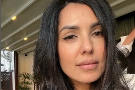 Tanja Savić o estetskim korekcijama: Zbog usana izgledam kao Silvester ...