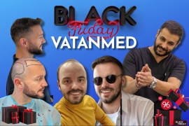 Petak je dan za novi početak: Transplantacija kose u Vatanmedu po ...