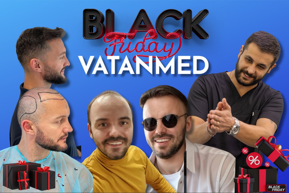 Petak je dan za novi početak: Transplantacija kose u Vatanmedu po posebnim Black Friday cijenama