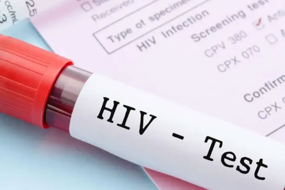 U ponedjeljak testiranje na HIV